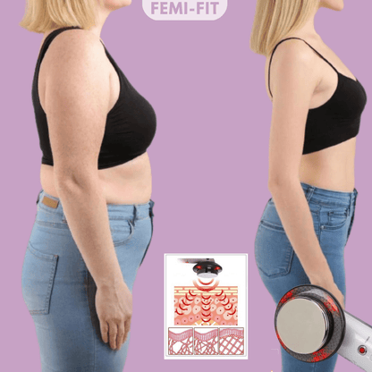 SLIMSHAPE 3-in-1 Cellulite and Fat Burner
