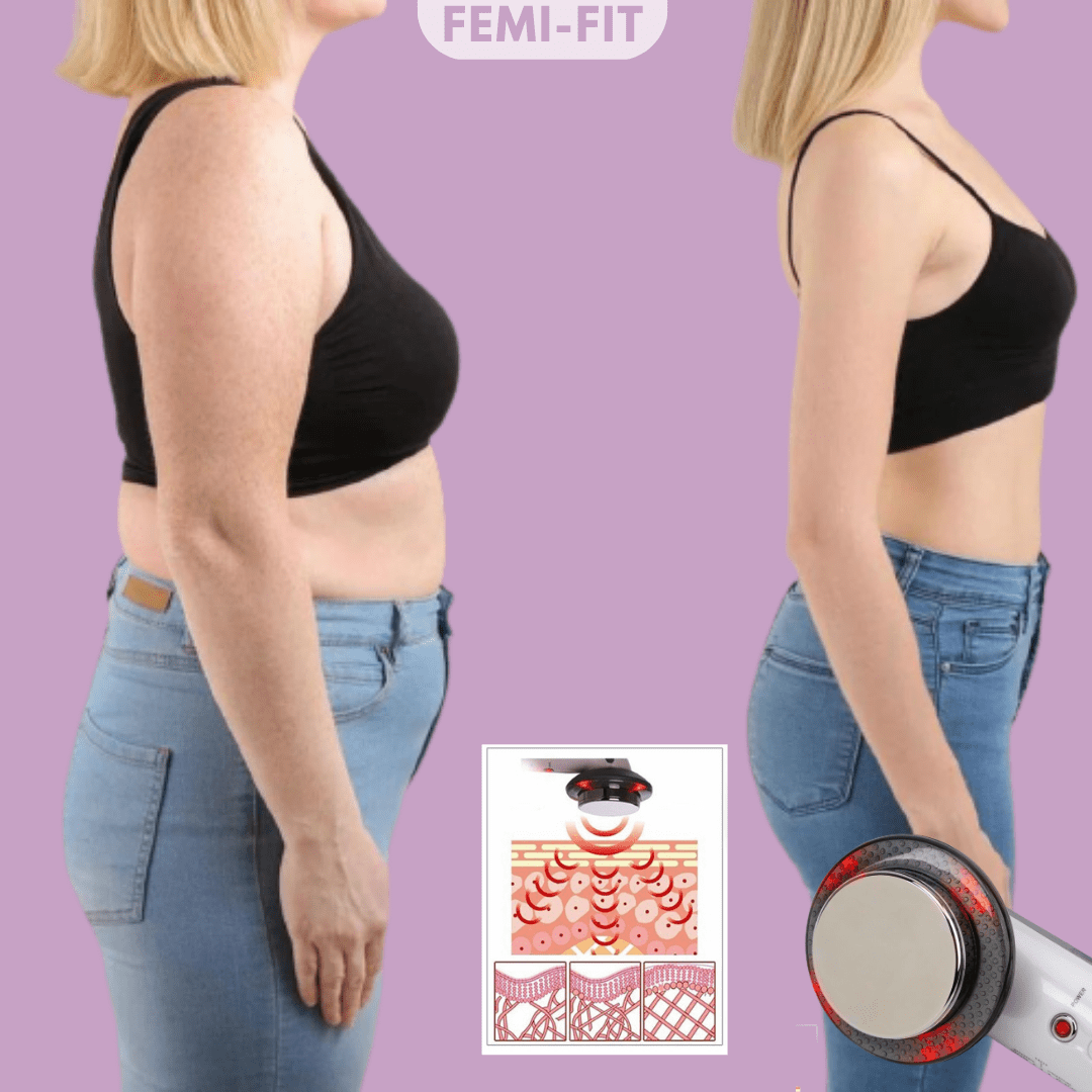 SLIMSHAPE 3-in-1 Cellulite and Fat Burner - iwt2