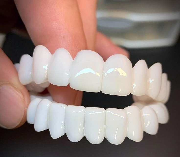 Flexible Snap On Tooth Veneers, Natural-Looking Cosmetic Veneers with Protective Storage Case