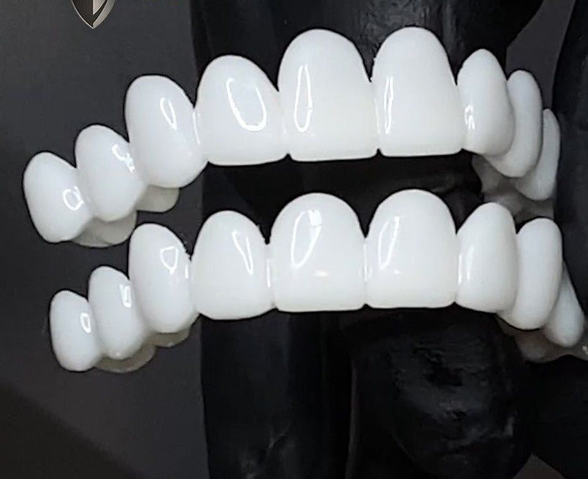 Flexible Snap On Tooth Veneers, Natural-Looking Cosmetic Veneers with Protective Storage Case – photo 5