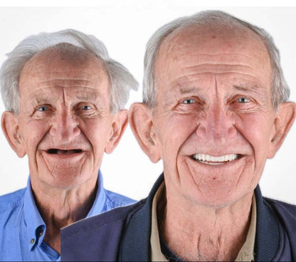 Heat and Fit Dentures – photo 12