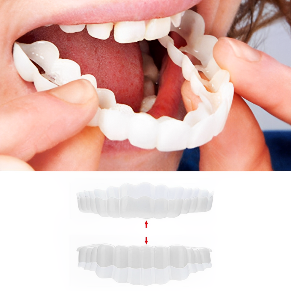 Hollywood Smile Snap On Veneers
