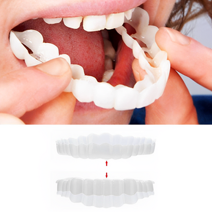 Hollywood Smile Snap On Veneers