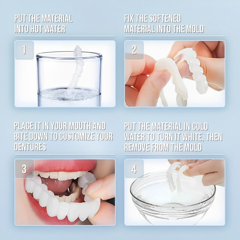Hollywood Smile Snap On Veneers – photo 7