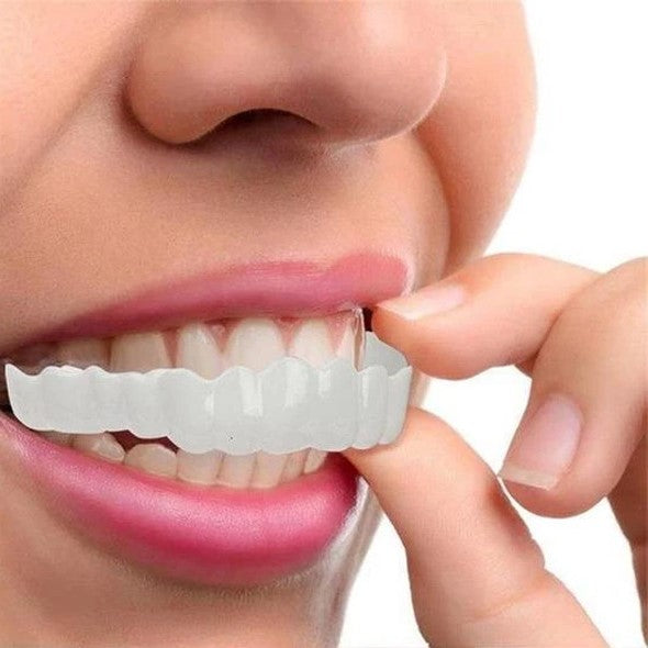Hollywood Smile Snap On Veneers – photo 8