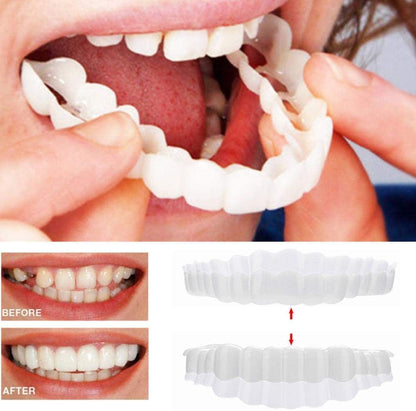 Hollywood Smile Snap On Veneers – photo 9