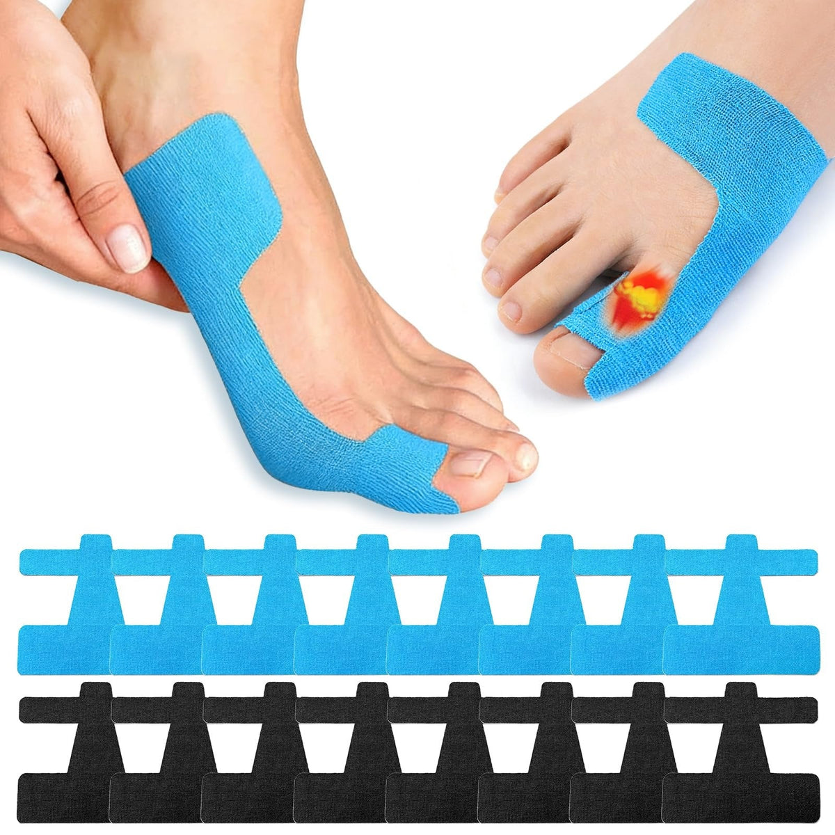 Bunion Corrector Brace, 80 Pieces