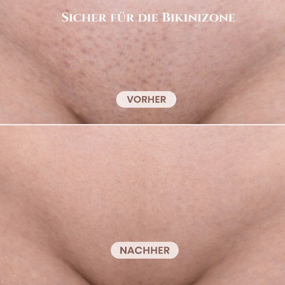 Women's Intimate Shaver with 2 Attachments