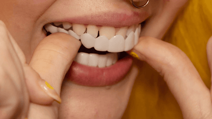 Moldable Snap On Veneers, Ultra Thin Polypropylene Cosmetic Veneers for Upper, Lower or Both Teeth – photo 11