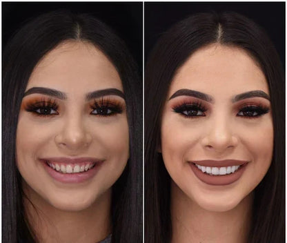 Moldable Snap On Veneers, Ultra Thin Polypropylene Cosmetic Veneers for Upper, Lower or Both Teeth – photo 6