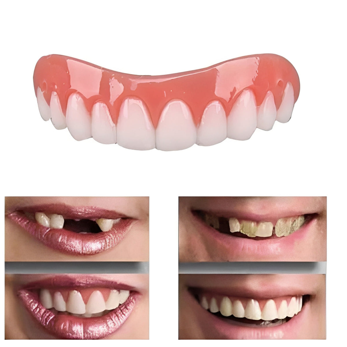 Snap On Dentures for Broken Teeth – photo 2