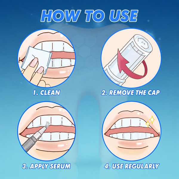 Teeth Whitening Pen, Peroxide Gel Pen with Precision Brush for Coffee, Tea & Red Wine Stains, 5 ml